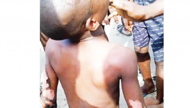 Children affected at Lagos Gas Explosion
