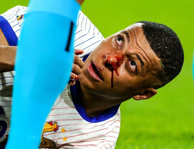 Photo of France captain, Kylian Mbappé